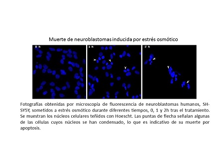 enjuague tramo recepción Muestran el proceso de activación de uno de los marcadores de Alzheimer -  Biotech Spain